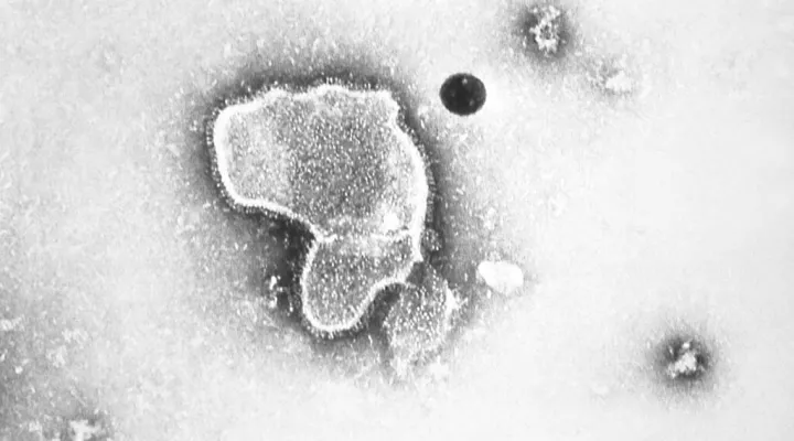 This 1981 photo provided by the Centers for Disease Control and Prevention (CDC) shows an electron micrograph of Respiratory Syncytial Virus, also known as RSV. Children's hospitals in parts of the country are seeing a distressing surge in RSV, a common respiratory illness that can cause severe breathing problems for babies. Cases fell dramatically two years ago as the pandemic shut down schools, day cares and businesses. Then, with restrictions easing, the summer of 2021 brought an alarming increase in wh…